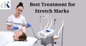 Best Treatment for Stretch Marks