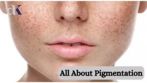 Pigmentation