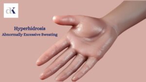 hyperhidrosis