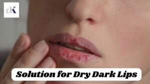 Dry Dark Lips