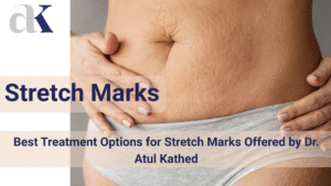 Best Dermatology in Indore
