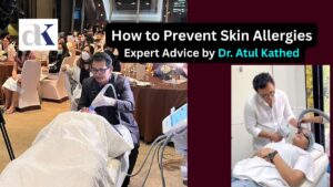 How to Prevent Skin Allergies – Expert Advice by Dr. Atul Kathed, Best Skin Specialist in Indore