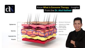 What is Exosome Therapy – Insights from the Best Hair Specialist in Indore