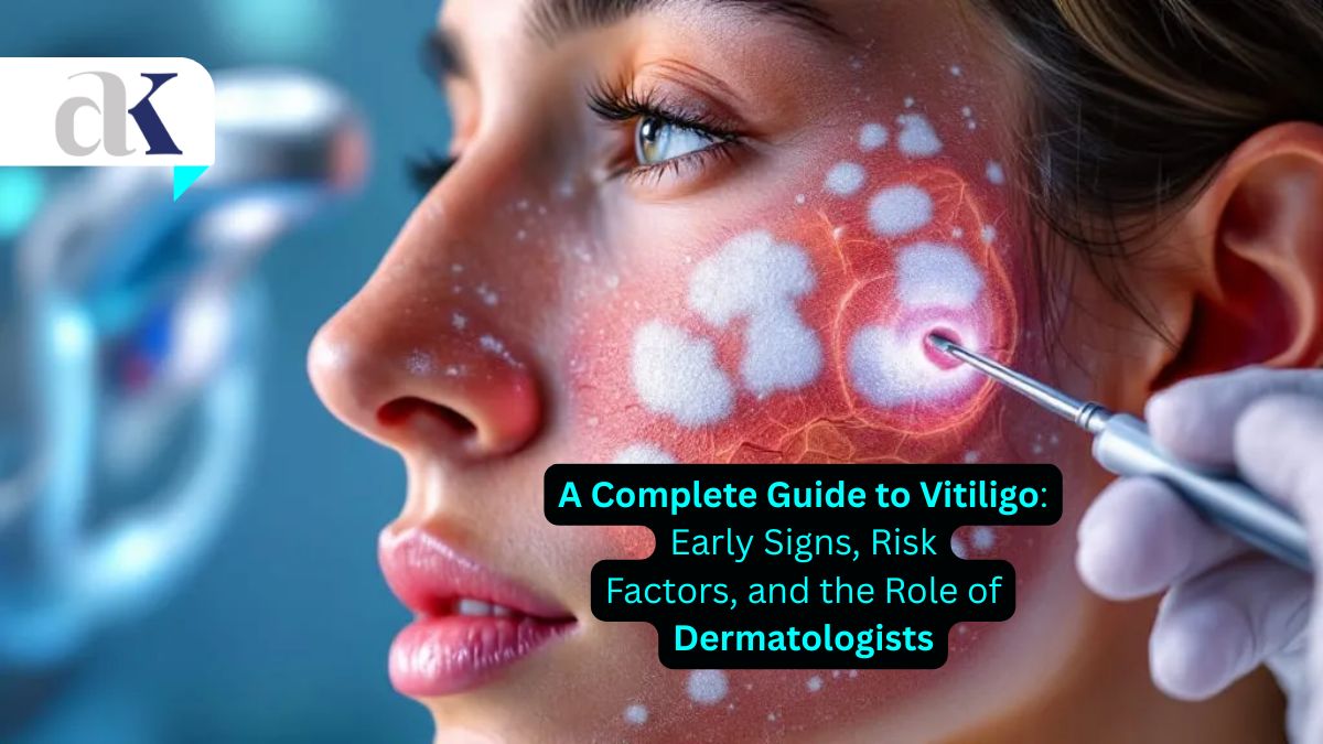 A Complete Guide to Vitiligo: Early Signs, Risk Factors, and the Role of Dermatologists