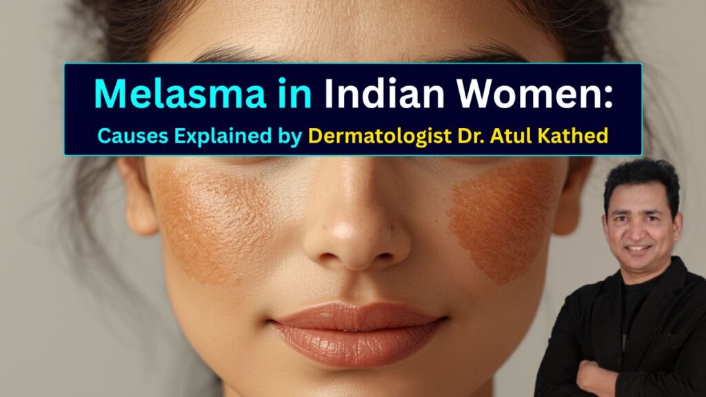 Melasma in Indian Women Causes Explained by Skin Specialist Dr. Atul Kathed