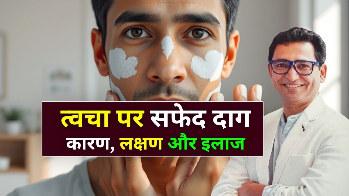त्वचा पर सफेद दाग होने के कारण, शुरुआती संकेत - Skin Specialist in Indore Dr. Atul Kathed