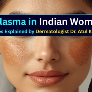 Why Is Melasma More Common in Indian Women?