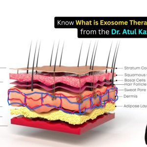 What is Exosome Therapy – Insights from the Best Hair Specialist in Indore