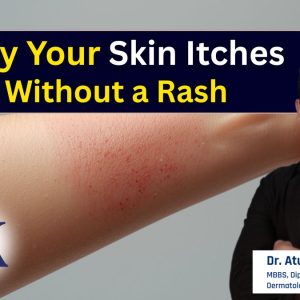 Why Your Skin Itches Even When Everything Looks Normal – And When It’s Serious