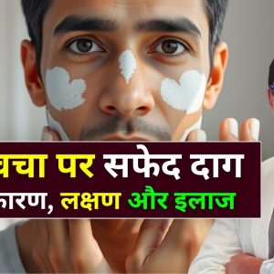 त्वचा पर सफेद दाग होने के कारण, शुरुआती संकेत - Skin Specialist in Indore Dr. Atul Kathed